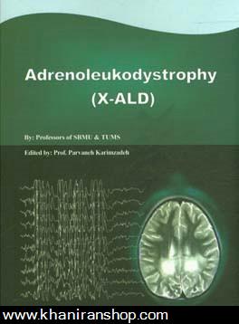 Adrenoleukodystrophy (X - ALD)